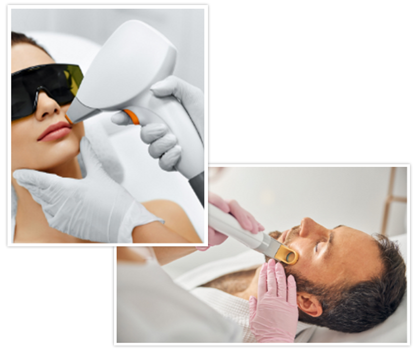 Laser Treatment for Hair Removal