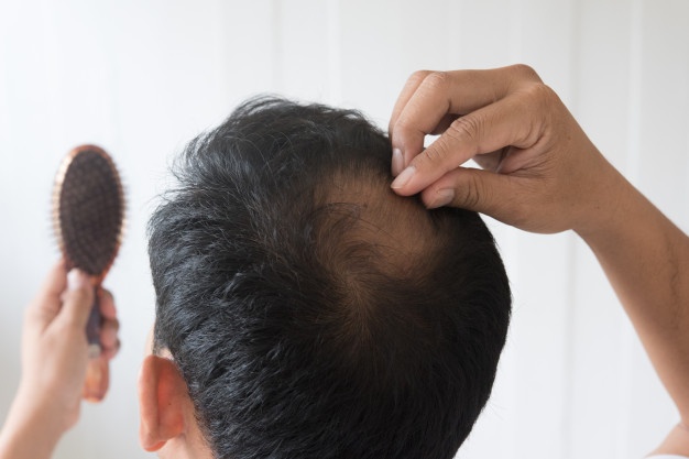 Losing Hair? Here’s the best solution for hair loss!
